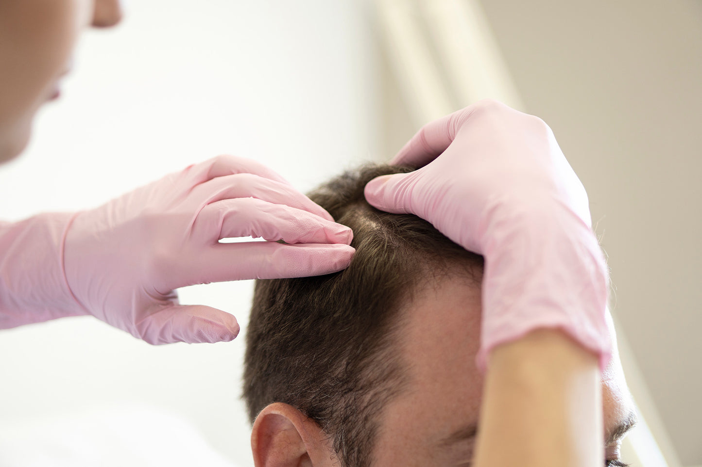 Hair Restoration | 3 Treatments + Product