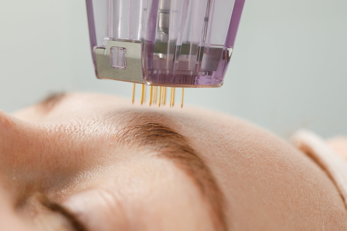 Pixel 8 MicroNeedling + RF